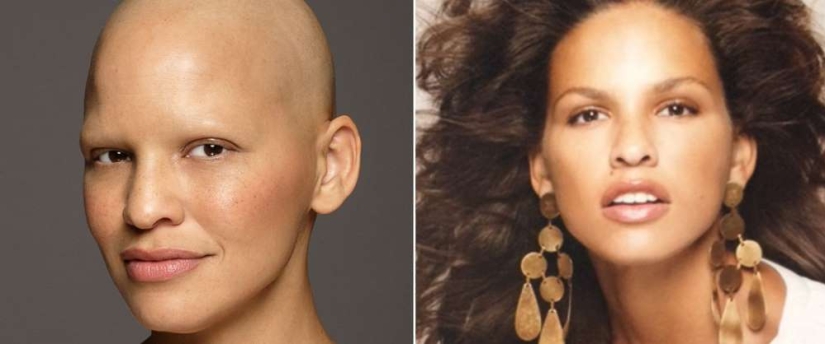 Model Mieko Rai: "I have stage three breast cancer and I have never felt more beautiful" Model Mieko Rai: "I have stage three breast cancer and I have never felt more beautiful"