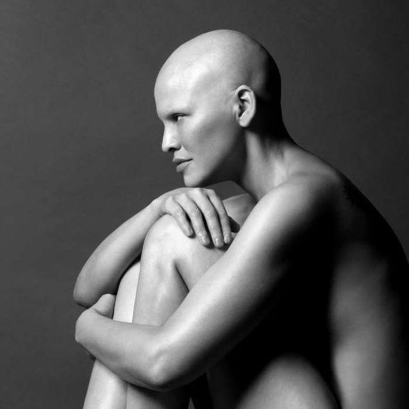 Model Mieko Rai: "I have stage three breast cancer and I have never felt more beautiful" Model Mieko Rai: "I have stage three breast cancer and I have never felt more beautiful"
