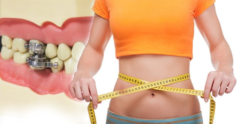 Mouth shut: scientists from New Zealand have come up with an ingenious way to lose weight