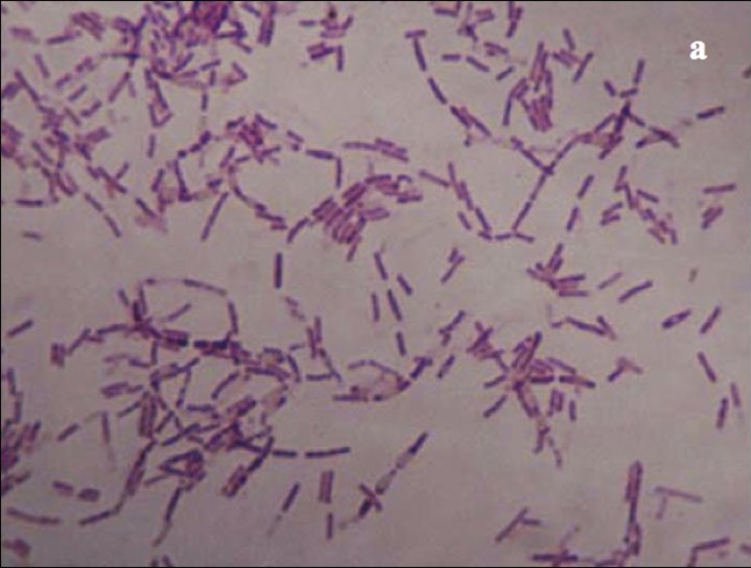 Mujer alemana inyecta bacterias antiguas en la sangre por el bien de la eterna juventud