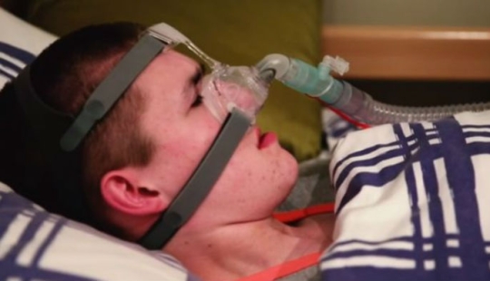 No duermas, morirás: un adolescente sufre del raro síndrome de la "Maldición de la Ondina"