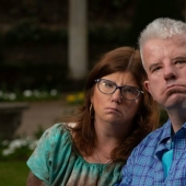 No saben sonreír, pero saben amar: un hombre y una mujer con una rara anomalía facial decidieron casarse