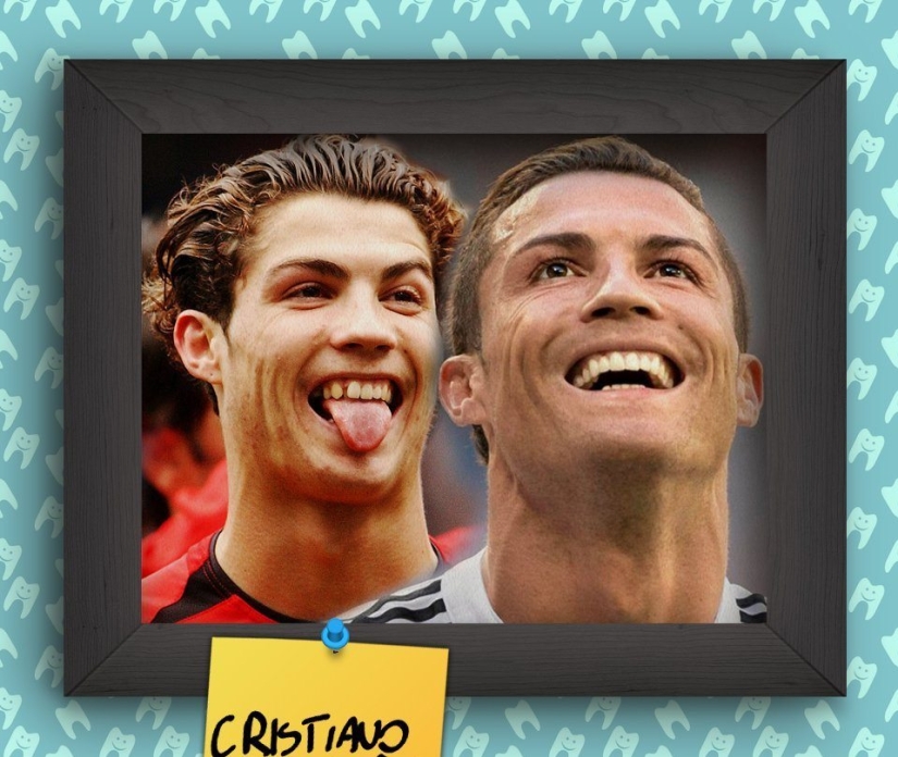 Non-Hollywood smiles of stars at the beginning of their career Non-Hollywood smiles of stars at the beginning of their career