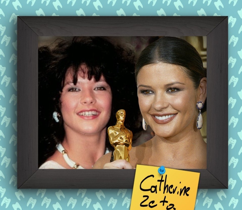 Non-Hollywood smiles of stars at the beginning of their career Non-Hollywood smiles of stars at the beginning of their career