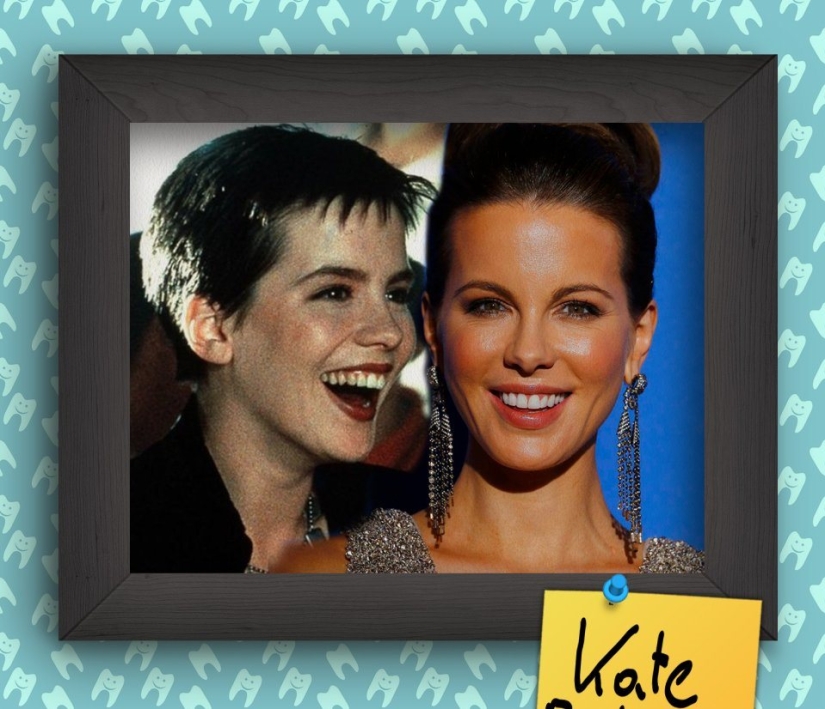 Non-Hollywood smiles of stars at the beginning of their career Non-Hollywood smiles of stars at the beginning of their career