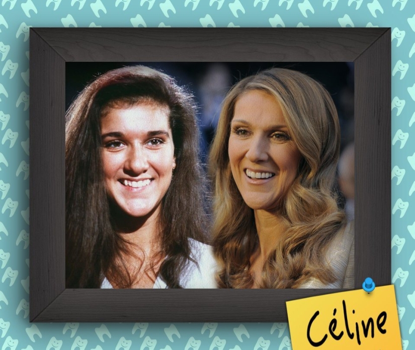 Non-Hollywood smiles of stars at the beginning of their career Non-Hollywood smiles of stars at the beginning of their career