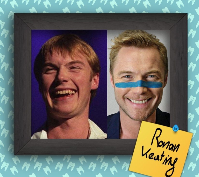 Non-Hollywood smiles of stars at the beginning of their career Non-Hollywood smiles of stars at the beginning of their career