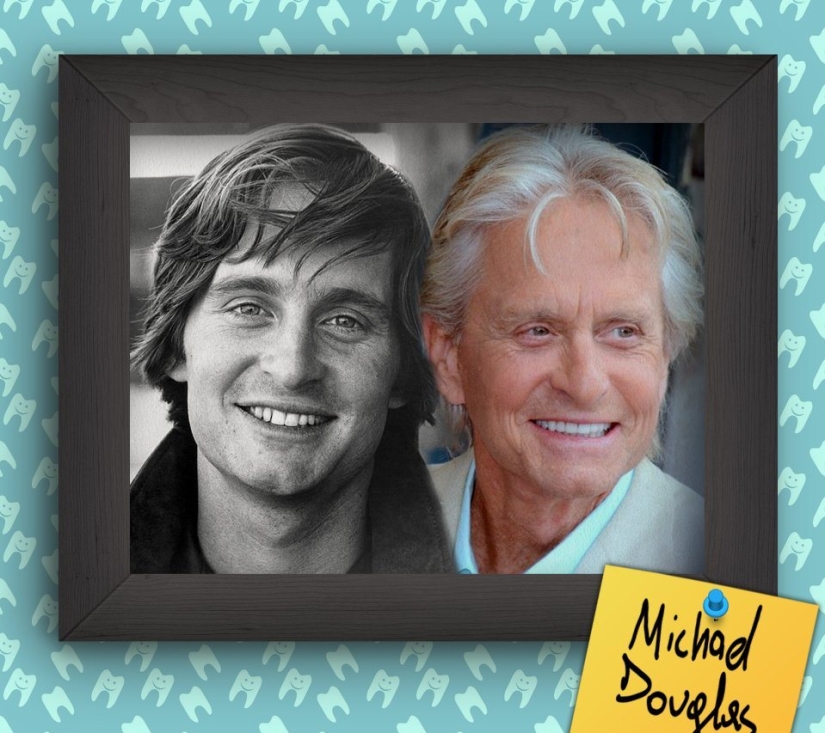 Non-Hollywood smiles of stars at the beginning of their career Non-Hollywood smiles of stars at the beginning of their career