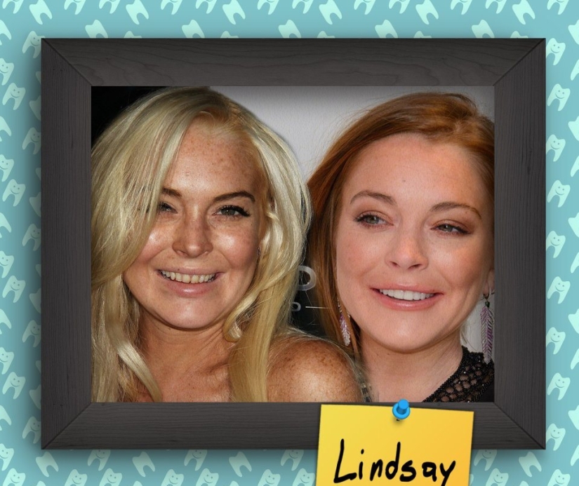 Non-Hollywood smiles of stars at the beginning of their career Non-Hollywood smiles of stars at the beginning of their career