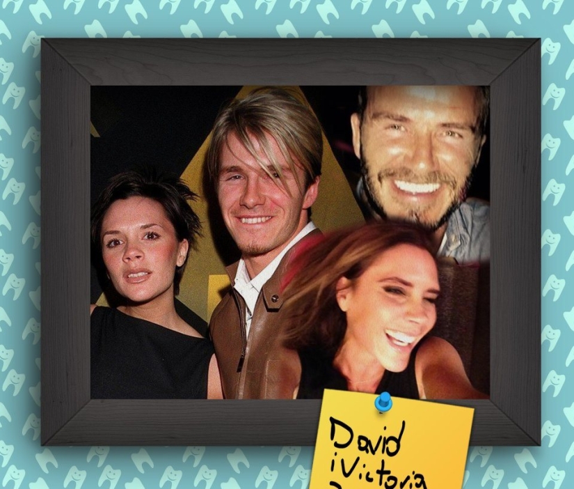 Non-Hollywood smiles of stars at the beginning of their career Non-Hollywood smiles of stars at the beginning of their career