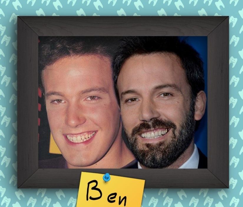 Non-Hollywood smiles of stars at the beginning of their career Non-Hollywood smiles of stars at the beginning of their career