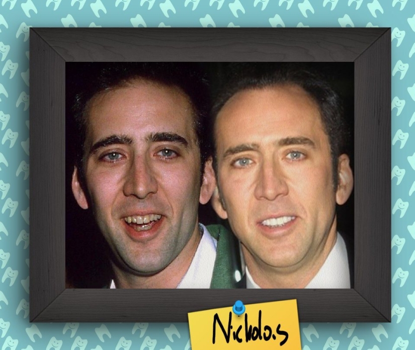 Non-Hollywood smiles of stars at the beginning of their career Non-Hollywood smiles of stars at the beginning of their career