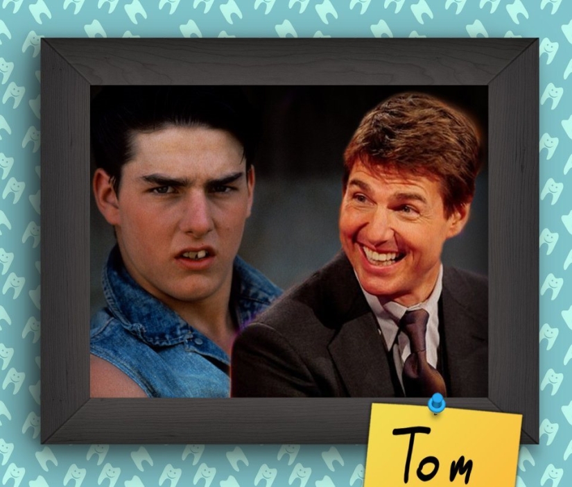 Non-Hollywood smiles of stars at the beginning of their career Non-Hollywood smiles of stars at the beginning of their career