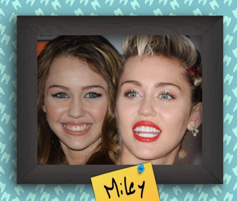 Non-Hollywood smiles of stars at the beginning of their career Non-Hollywood smiles of stars at the beginning of their career