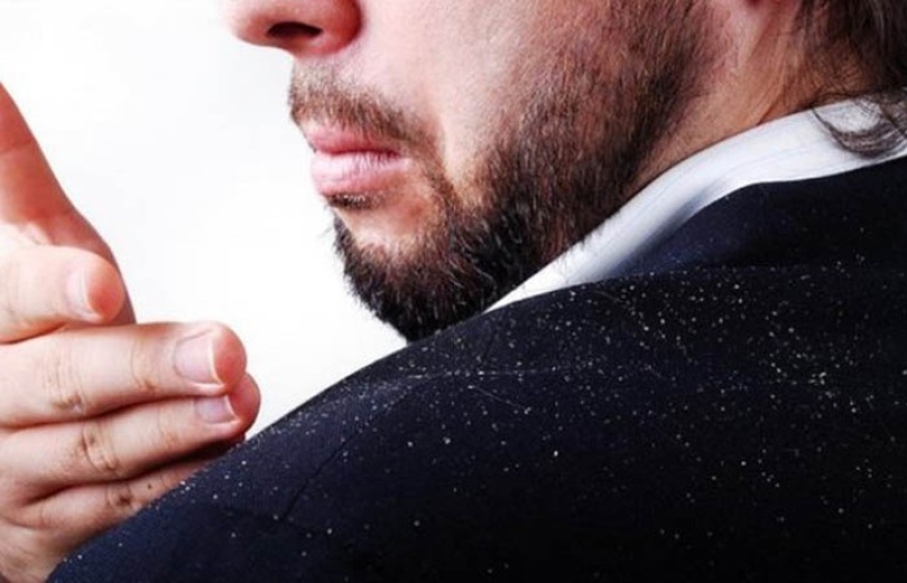 Not only inside: 12 most unusual, but effective ways to use vodka Not only inside: 12 most unusual, but effective ways to use vodka