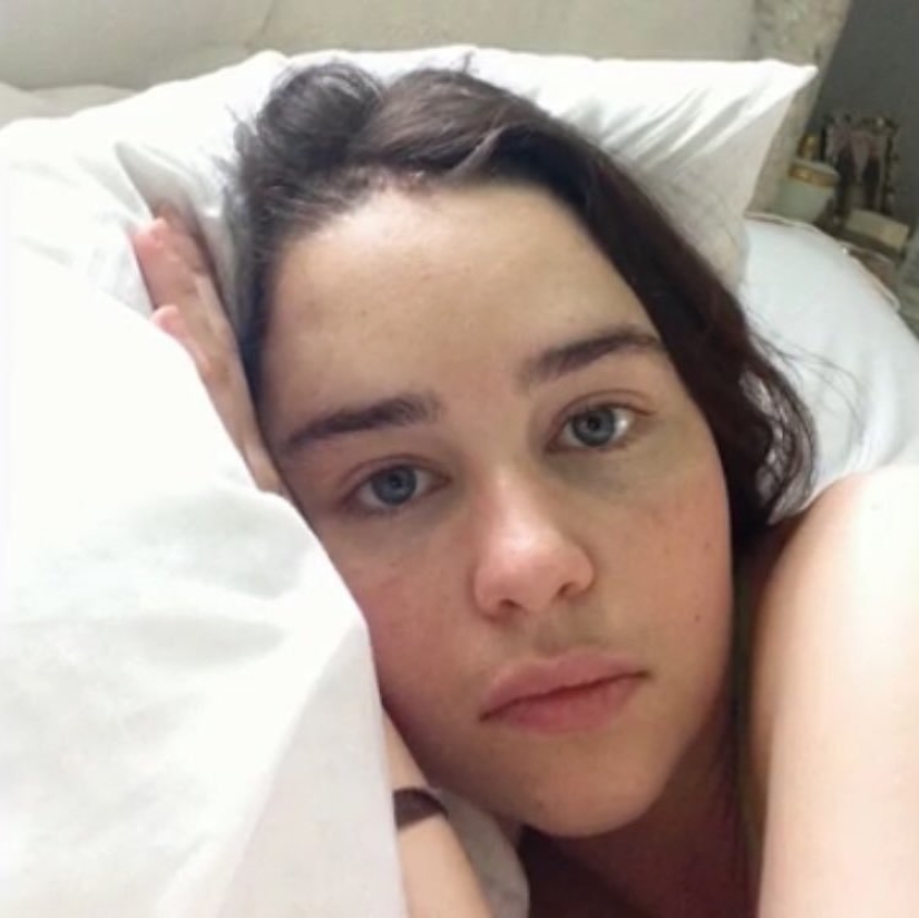 Photos of Emilia Clarke after a stroke and skull trepanation appeared on the web Photos of Emilia Clarke after a stroke and skull trepanation appeared on the web