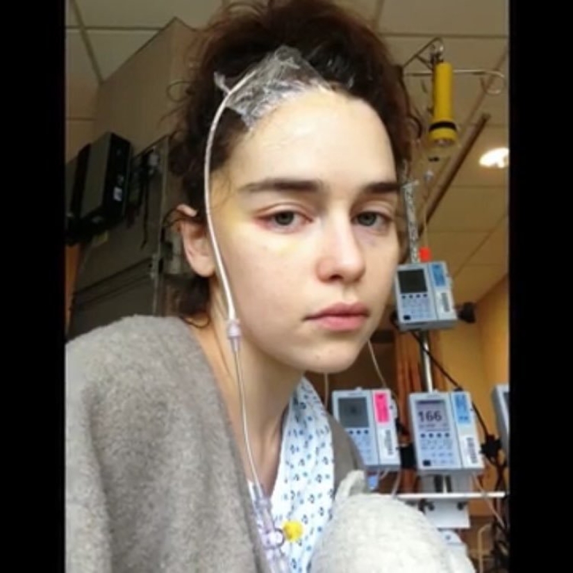 Photos of Emilia Clarke after a stroke and skull trepanation appeared on the web Photos of Emilia Clarke after a stroke and skull trepanation appeared on the web