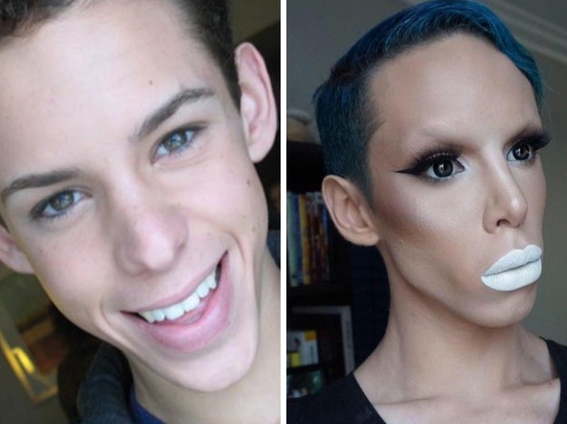 Plastic surgery victims - men
