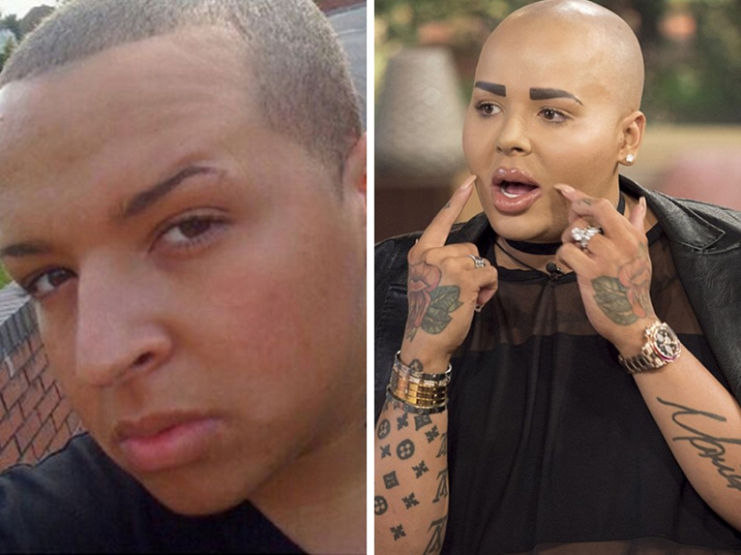 Plastic surgery victims - men