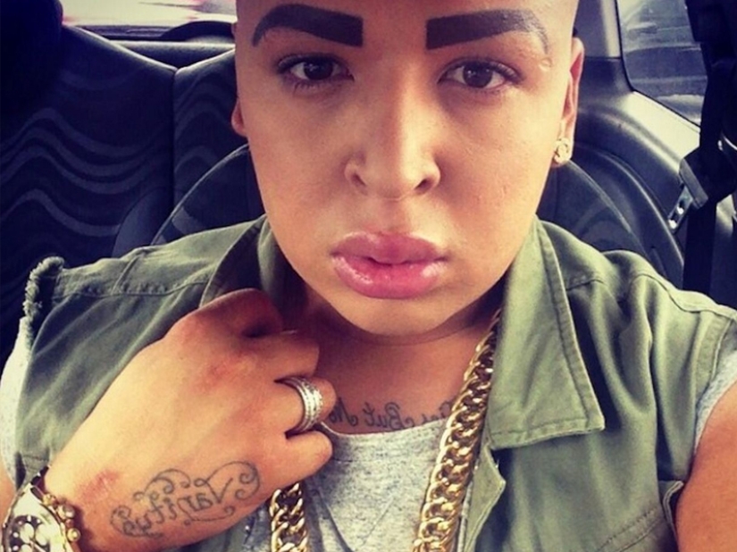 Plastic surgery victims - men