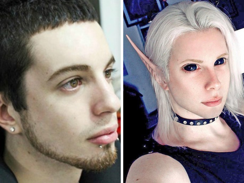 Plastic surgery victims - men