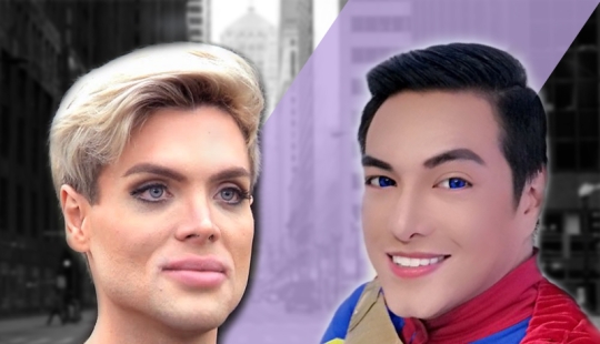 Plastic surgery victims - men Plastic surgery victims - men