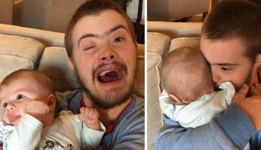 Por qué prácticamente no hay personas con síndrome de Down en Islandia Por qué prácticamente no hay personas con síndrome de Down en Islandia