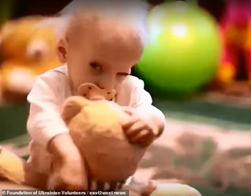 ¿Por qué una mujer ucraniana morir de vejez a la edad de 8