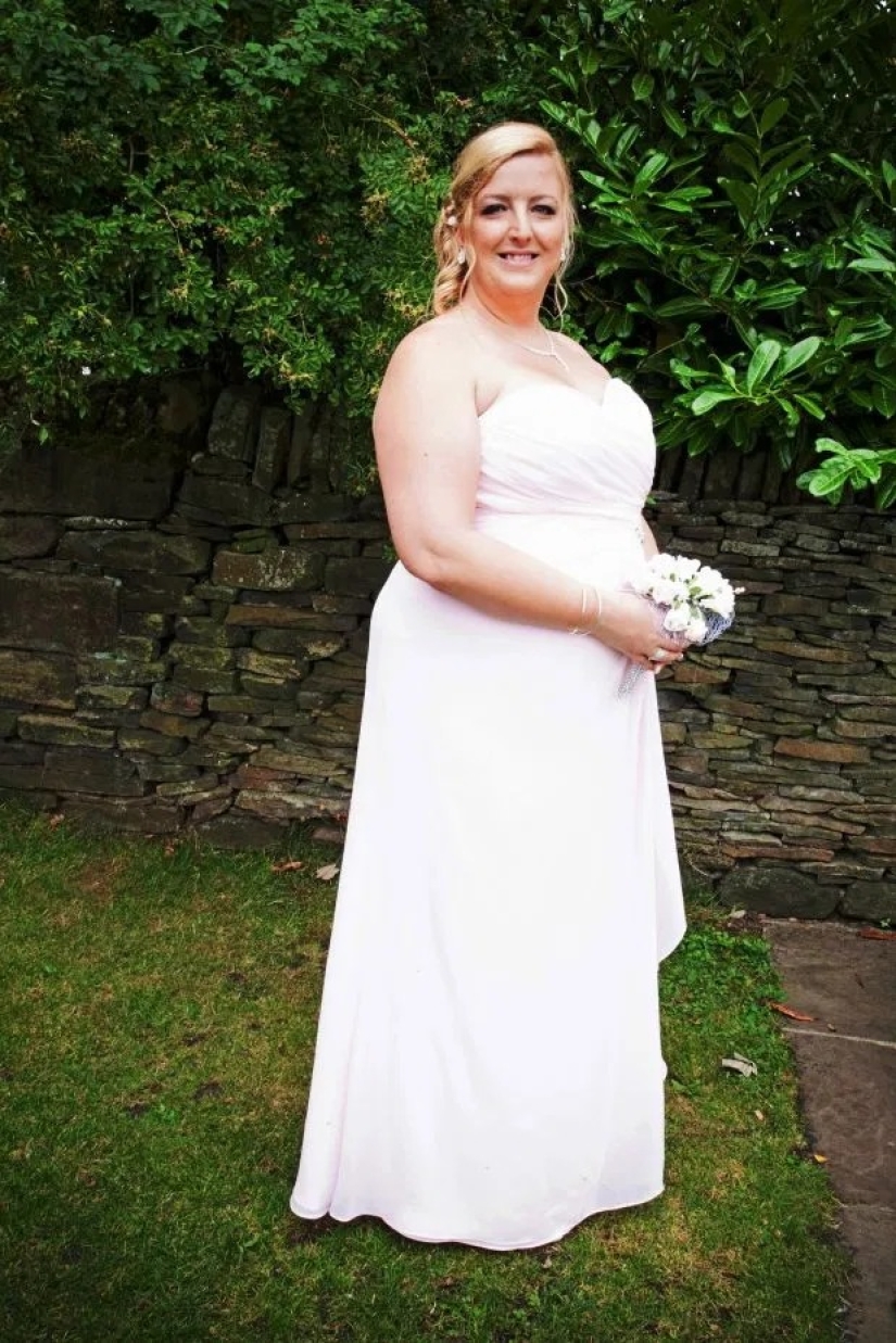 Pulled herself together: the woman got rid of snoring and lost 89 kg, refusing gastric banding