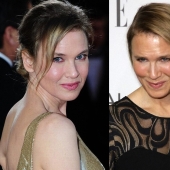 ¿Qué pasó con René Zellweger?