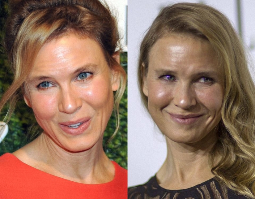 ¿Qué pasó con René Zellweger?