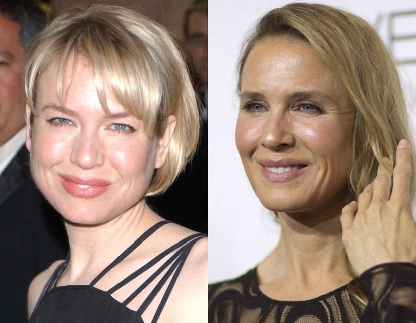 ¿Qué pasó con René Zellweger?
