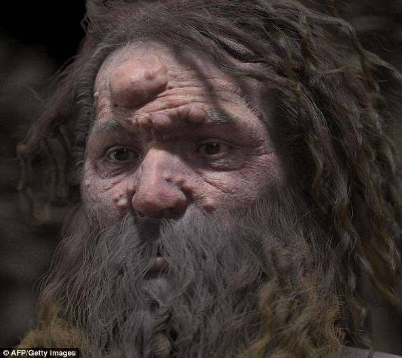 Scientists have recreated the appearance of a Cro-Magnon, whose face is covered with tumors