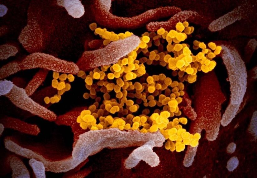 Scientists have shown what the Covid-19 coronavirus looks like under a microscope Scientists have shown what the Covid-19 coronavirus looks like under a microscope