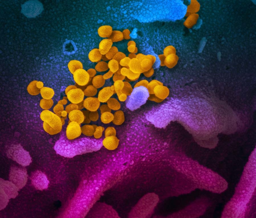 Scientists have shown what the Covid-19 coronavirus looks like under a microscope Scientists have shown what the Covid-19 coronavirus looks like under a microscope