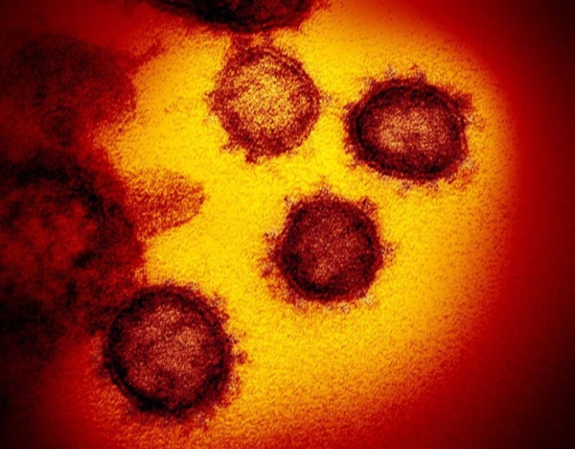 Scientists have shown what the Covid-19 coronavirus looks like under a microscope Scientists have shown what the Covid-19 coronavirus looks like under a microscope