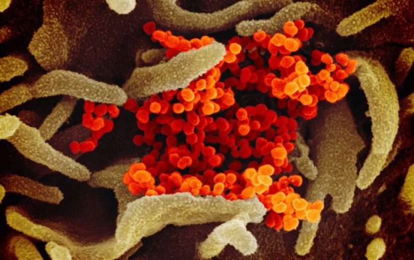 Scientists have shown what the Covid-19 coronavirus looks like under a microscope Scientists have shown what the Covid-19 coronavirus looks like under a microscope