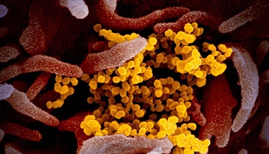 Scientists have shown what the Covid-19 coronavirus looks like under a microscope