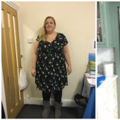 Se recuperó: la mujer se deshizo de los ronquidos y perdió 89 kg, rechazando la banda gástrica Se recuperó: la mujer se deshizo de los ronquidos y perdió 89 kg, rechazando la banda gástrica