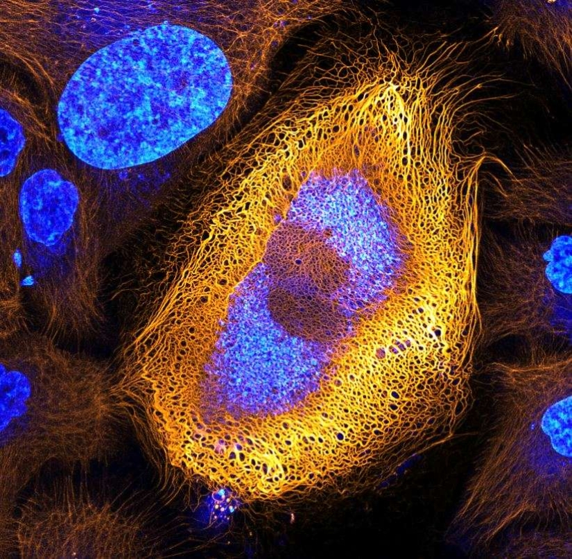 Sex of weevils, the head of a worm, the beauty of mold: Nikon Small World photo contest announced the winners Sex of weevils, the head of a worm, the beauty of mold: Nikon Small World photo contest announced the winners