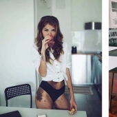 Signos especiales: debido a las marcas de nacimiento, la niña fue apodada "dálmata", pero se considera sexy