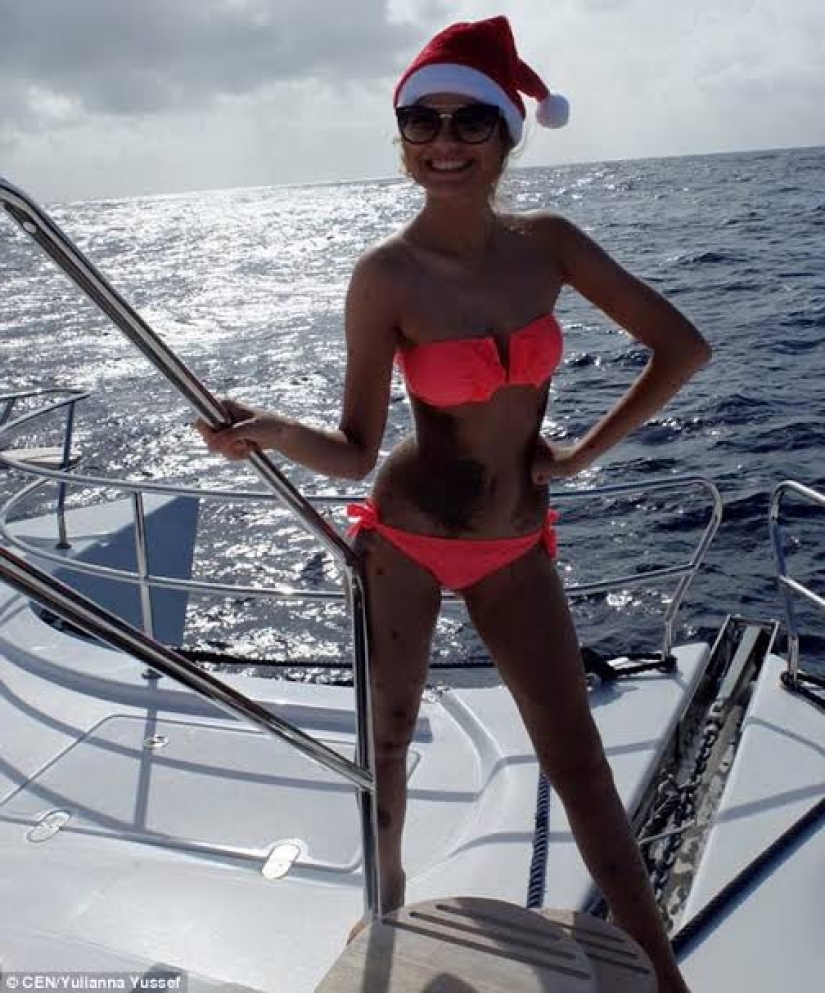 Signos especiales: debido a las marcas de nacimiento, la niña fue apodada "dálmata", pero se considera sexy