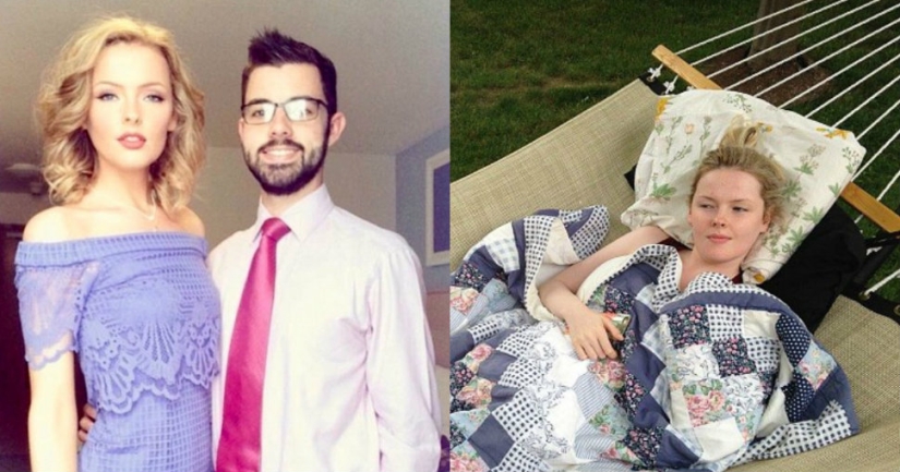 Sleeping Beauty: A British woman who once slept for six months still hardly wakes up