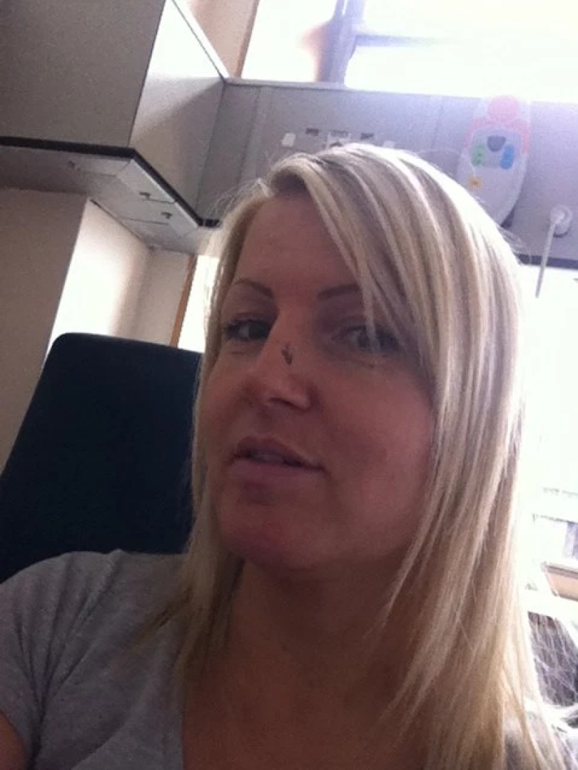 Solar ataúd: estas mujeres han adquirido un bonito bronceado y el cáncer de piel después de Solarium