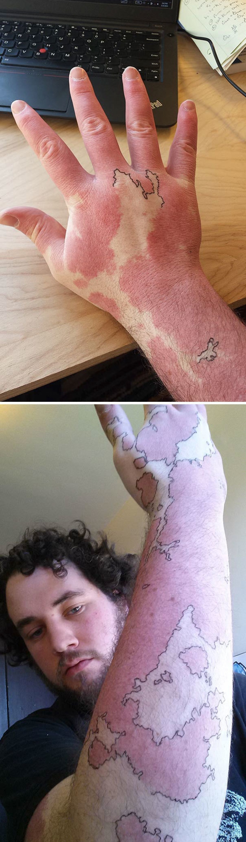 Tattoos that hide birthmarks Tattoos that hide birthmarks