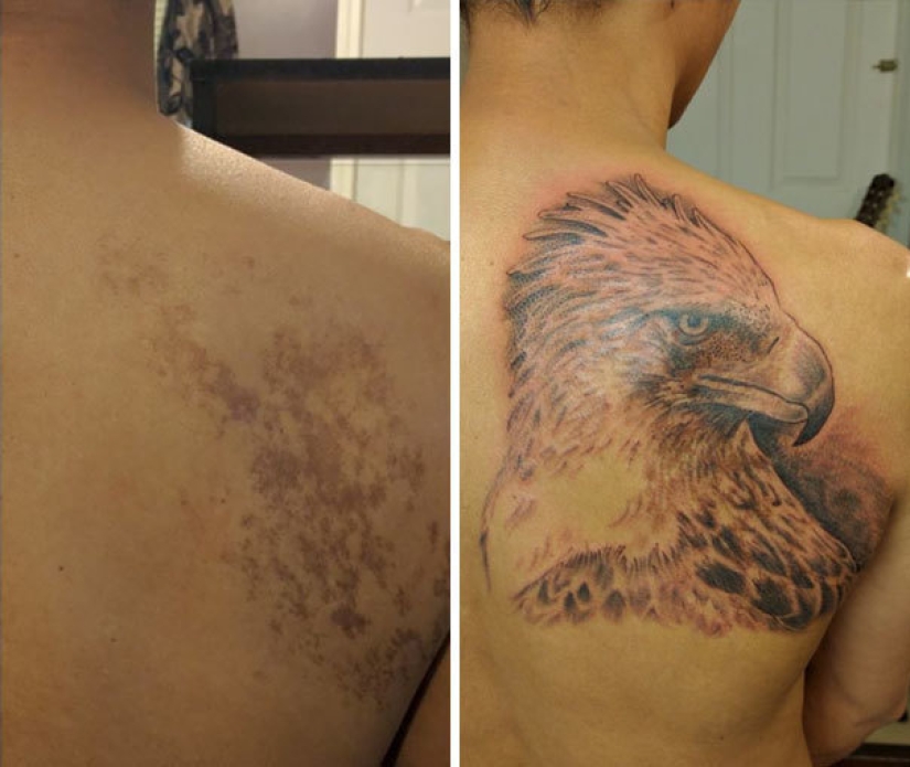 Tatuajes que ocultan marcas de nacimiento