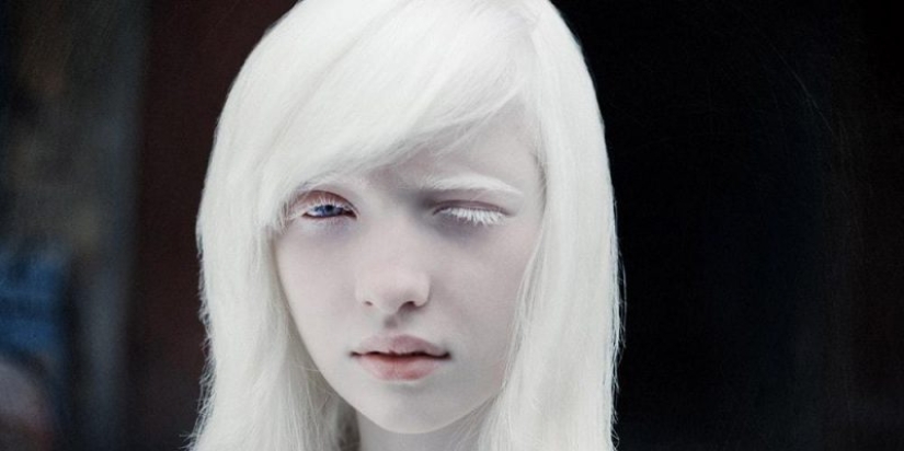 The albino girl, who was an outcast at Moscow school, conquered the fashion world