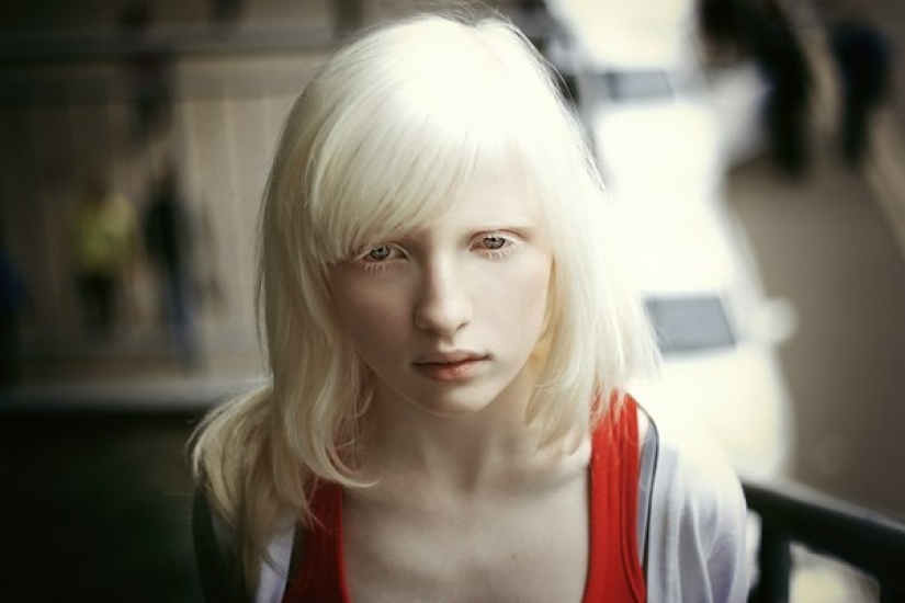 The albino girl, who was an outcast at Moscow school, conquered the fashion world