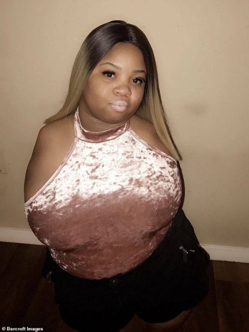 The all-conquering power of love: a girl without arms and legs marries a completely healthy man