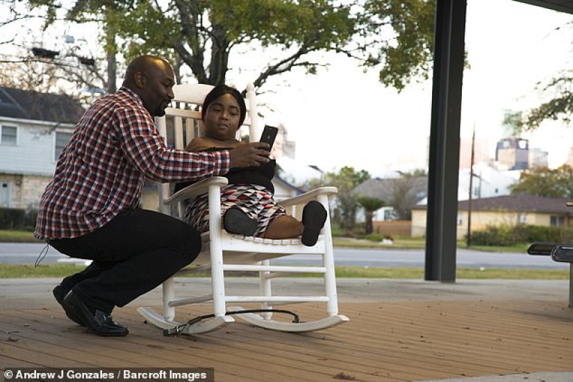 The all-conquering power of love: a girl without arms and legs marries a completely healthy man The all-conquering power of love: a girl without arms and legs marries a completely healthy man